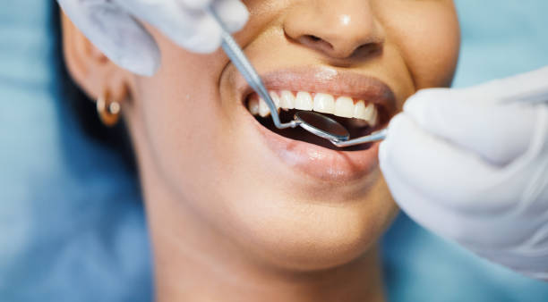 Best Emergency Treatment for Dental Infections or Abscesses in Bishop, TX